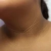 Cách chữa bệnh gai đen tại nhà và những lưu ý quan trọng