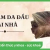 Cách trị nấm da đầu bằng dung dịch vệ sinh: Hiệu quả và lưu ý