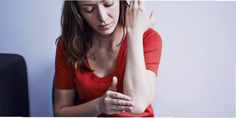 Bôi kem chứa corticosteroids giúp giảm viêm và ngứa do tổ đỉa