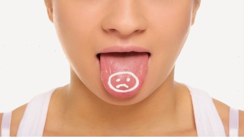 Cách điều trị tê lưỡi hiệu quả tại nhà và khi nào cần đi khám bác sĩ