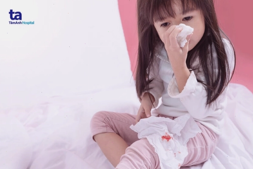Cách sơ cứu chảy máu cam cho trẻ em và người lớn đúng cách