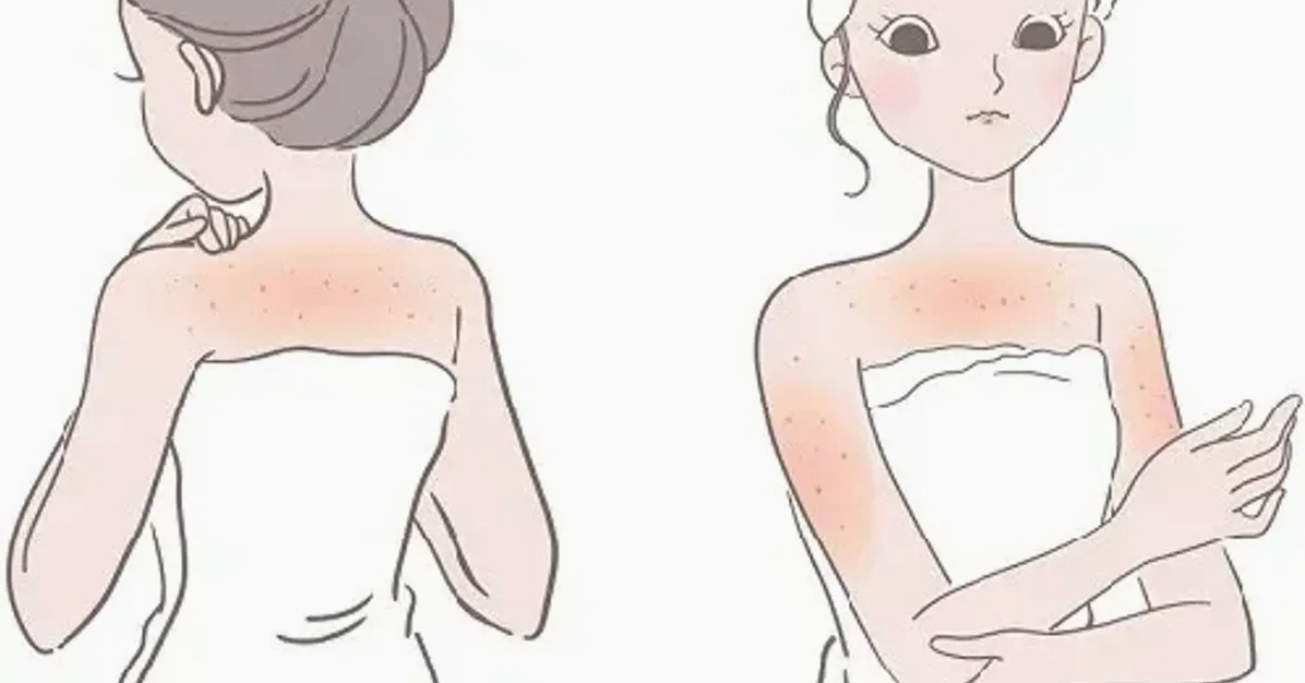 Cách trị viêm lỗ chân lông ở chân tại nhà hiệu quả
