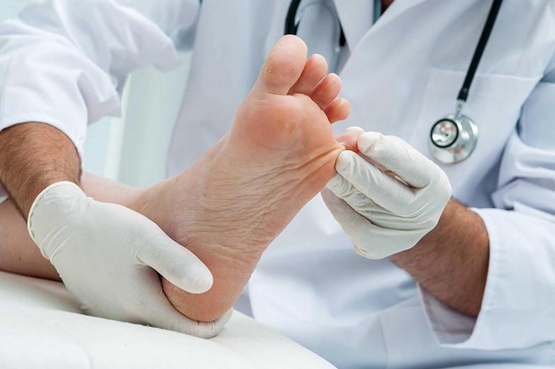 Giải đáp chi tiết cách chữa bệnh tổ đỉa hiệu quả tại nhà