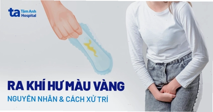 Hình ảnh minh họa tình trạng ra khí hư màu vàng ở phụ nữ