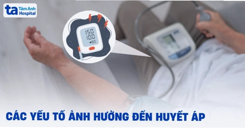 Huyết áp 150/100 mmHg có nguy hiểm không
