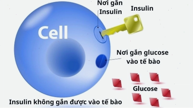 Kháng insulin là nguyên nhân hay gặp nhất gây nên bệnh gai đen