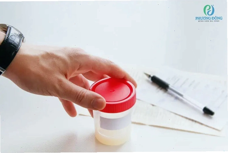 Lượng tinh dịch thu được cần được chuyển ngay tới phòng lab