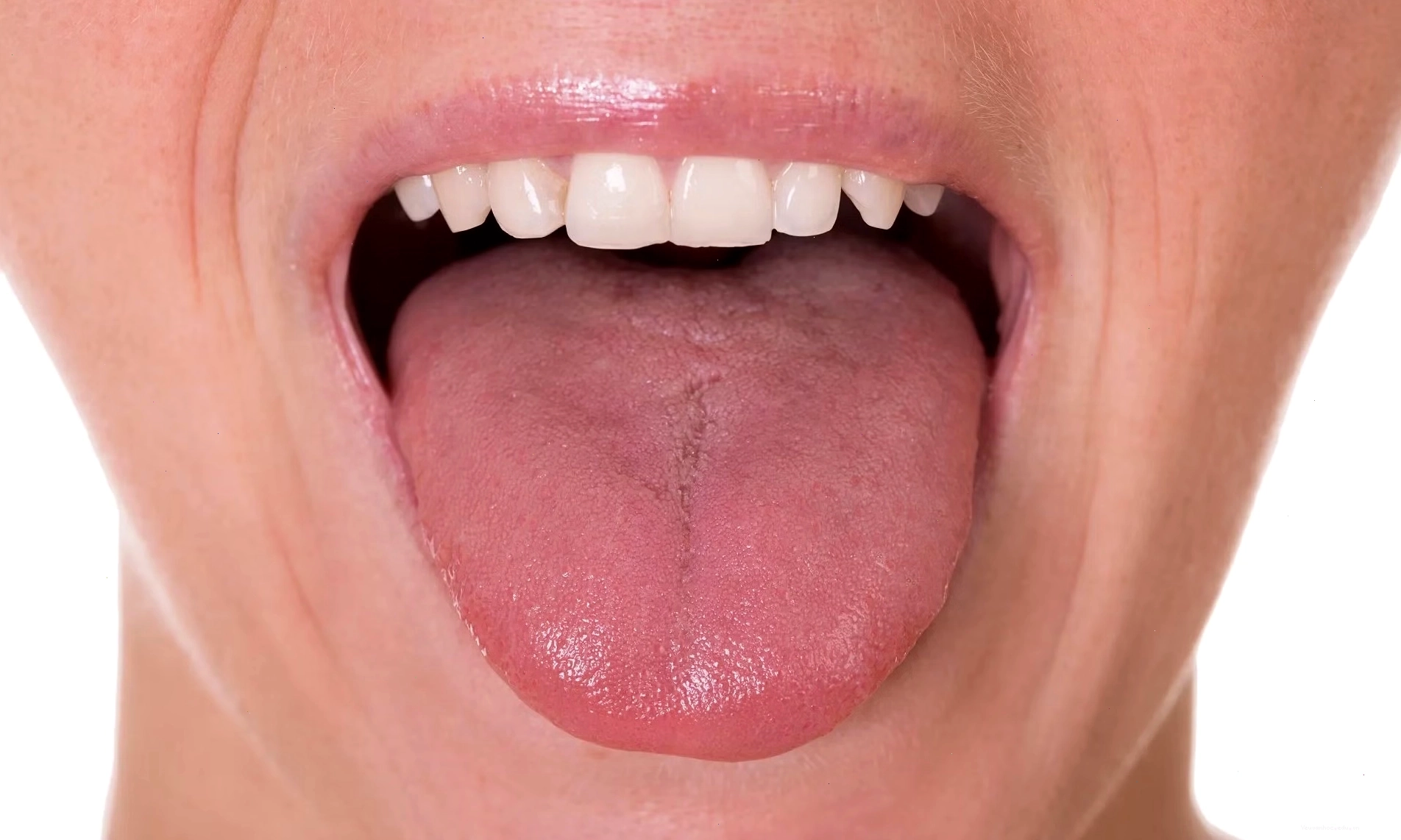 Miệng bỏng rát có thể do nhiều nguyên nhân