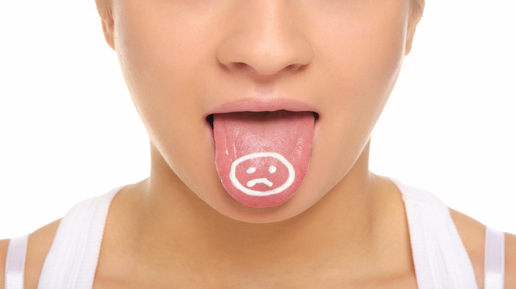 Tê đầu lưỡi là dấu hiệu của bệnh gì và cách điều trị hiệu quả