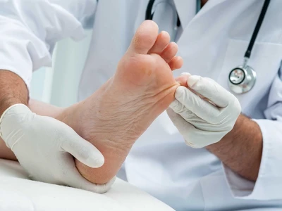 Giải đáp chi tiết cách chữa bệnh tổ đỉa hiệu quả tại nhà